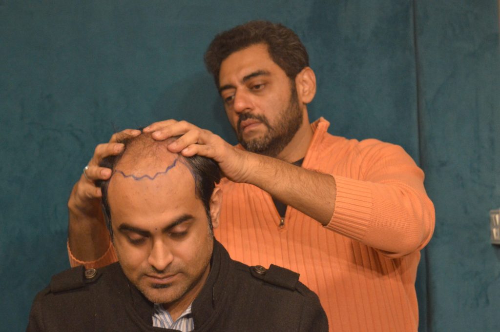 Best Hair Club in Lahore