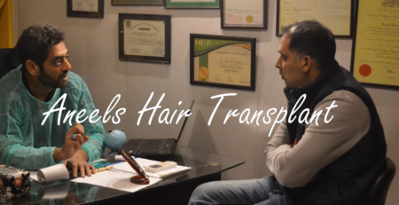 Dr Aneel Discussing when to get hair transplant in Lahore