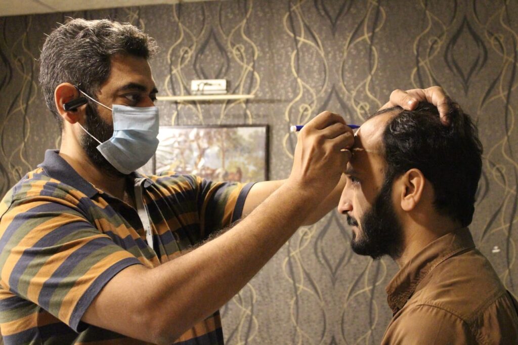 Aneels Hair Transplant a best hair club in lahore