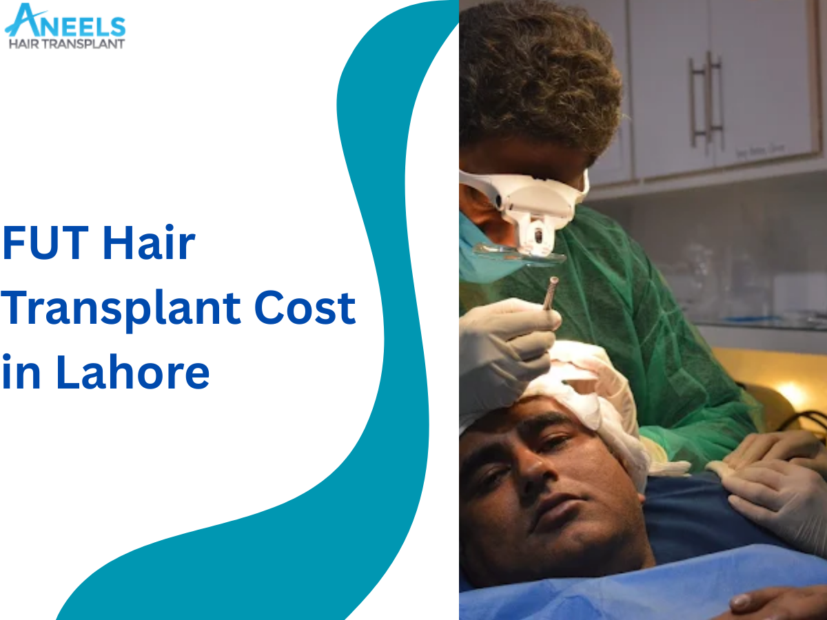 FUT Hair Transplant Cost in Lahore