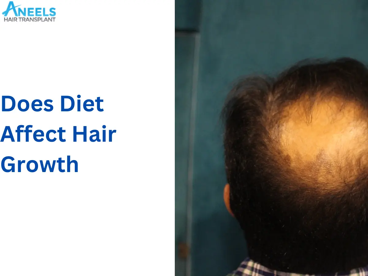 Does Diet Affect Hair Growth