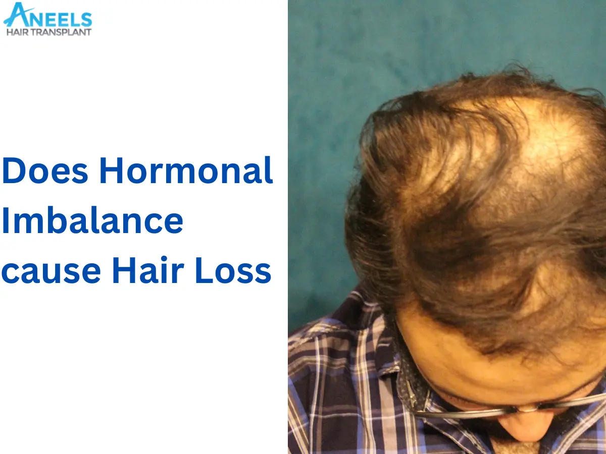Does Hormonal Imbalance cause Hair Loss