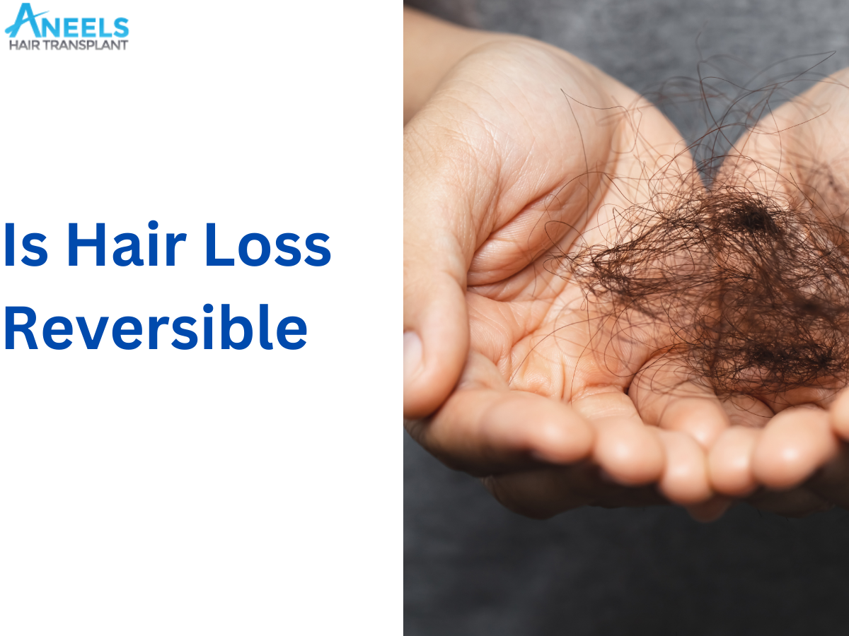 Is Hair Loss Reversible