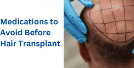 Medications to Avoid Before Hair Transplant