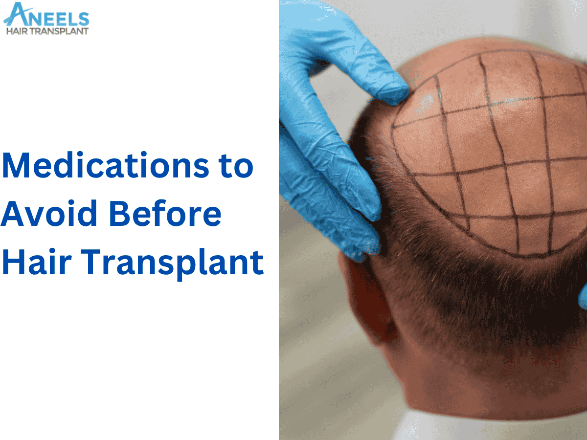 Medications to Avoid Before Hair Transplant