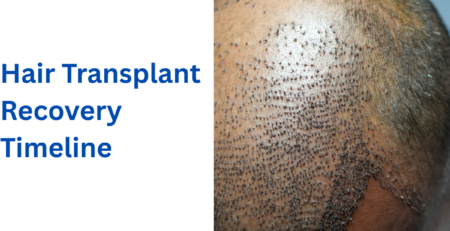 Hair Transplant Recovery Timeline