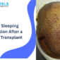 Best Sleeping Position After a Hair Transplant