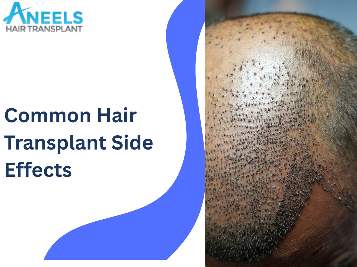 Common Hair Transplant Side Effects