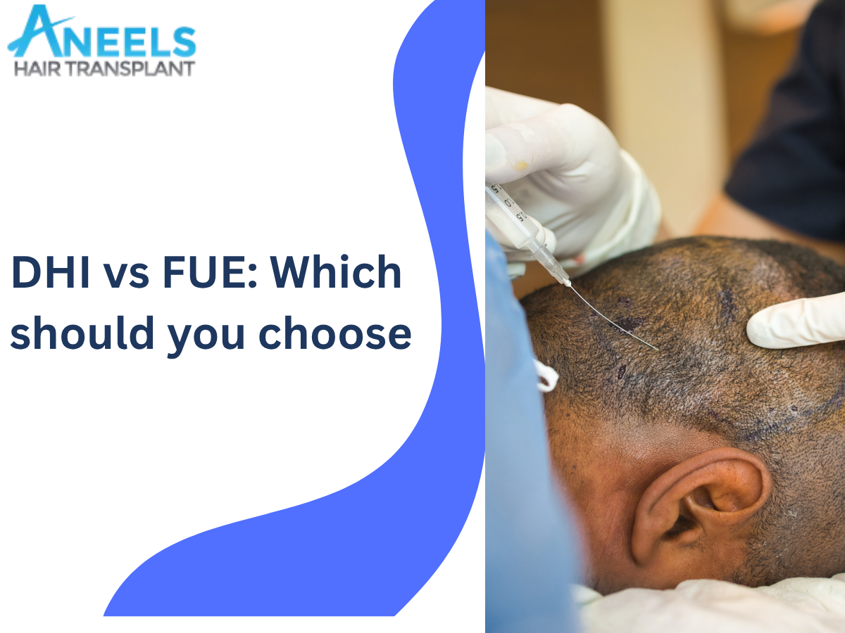 Dhioff DHI vs FUE: Which Hair Transplant Is Right for You?