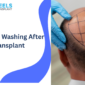 Hair Washing After a Transplant