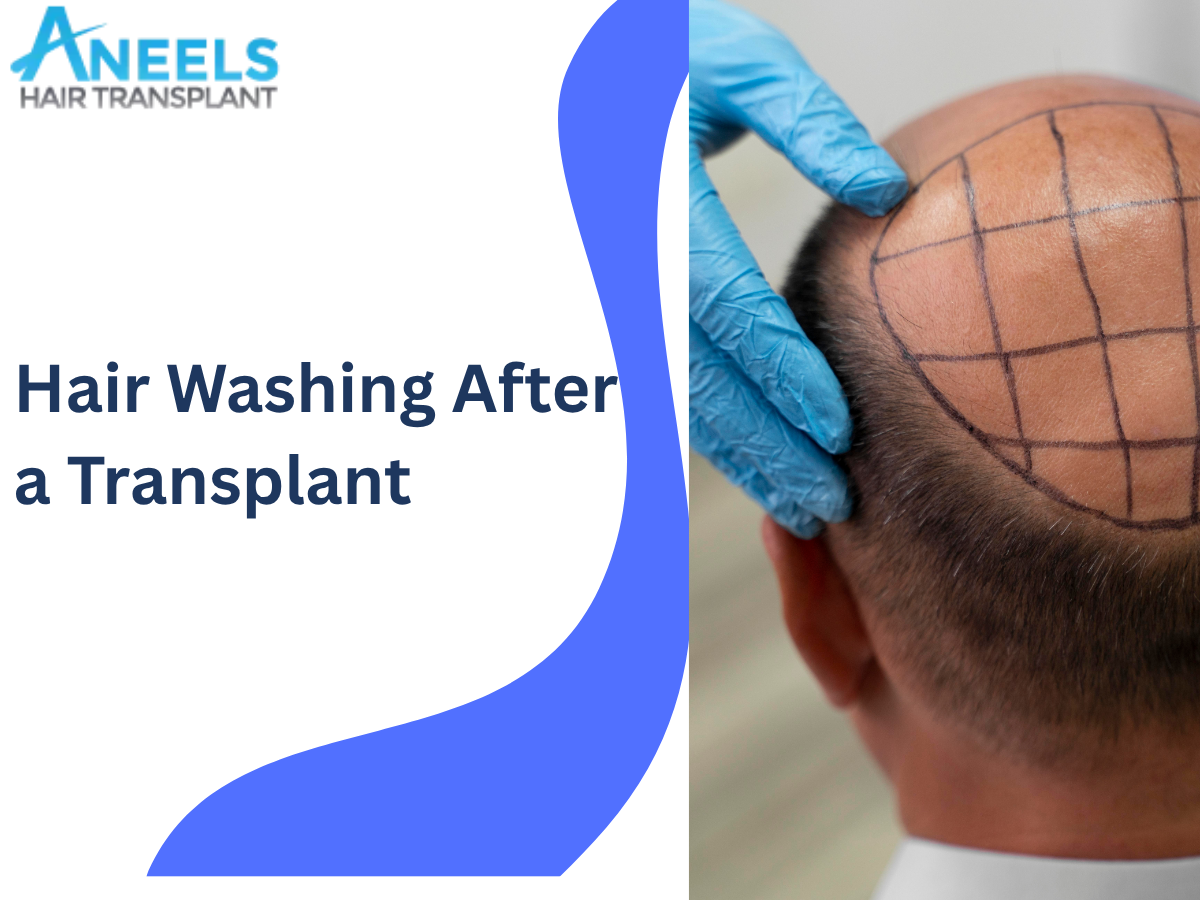 Hair Washing After a Transplant