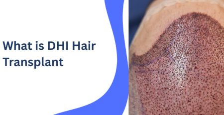 What is DHI Hair Transplant