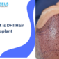 What is DHI Hair Transplant