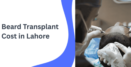 Beard Transplant Cost in Lahore
