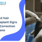 Failed Hair Transplant Signs