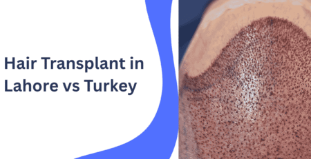 Hair Transplant in Lahore vs Turkey