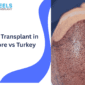 Hair Transplant in Lahore vs Turkey