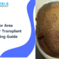 Donor Area After Hair Transplant: Healing and Regrowth Guide